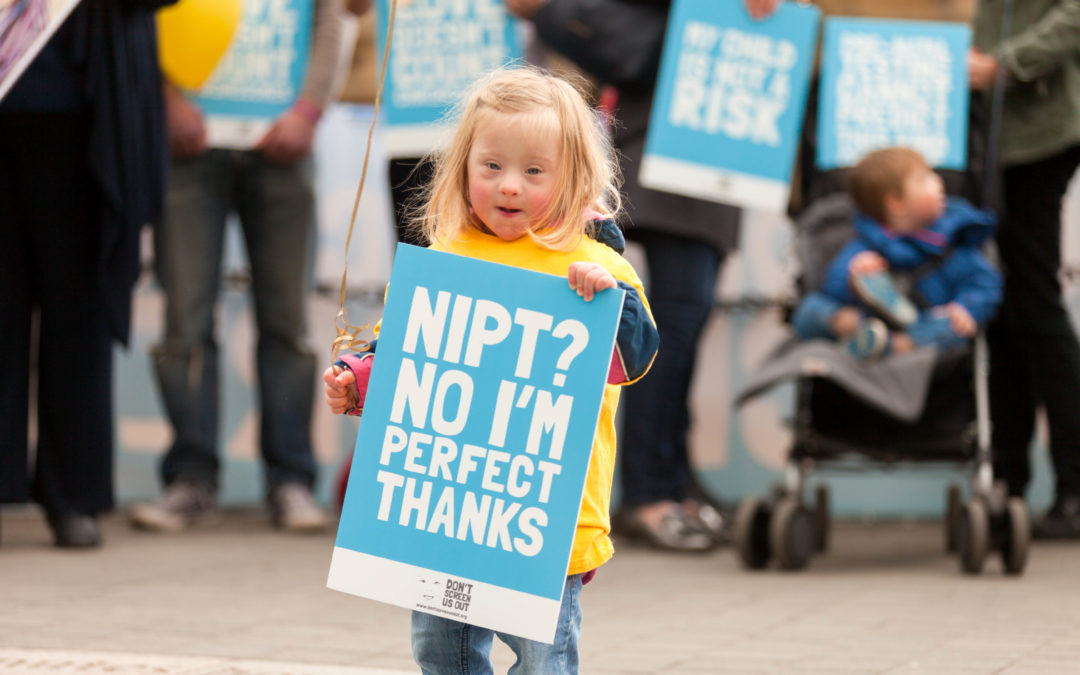 Abortions for Down’s syndrome up – set to get worse if Government screening proposals go ahead