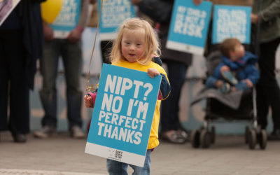 New abortion statistics release shows abortions for Down’s syndrome up – set to get worse as Government rolls out new screening programme on NHS