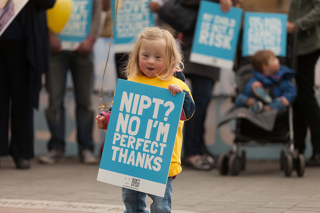 PRESS RELEASE: Public concern mounts over new Down’s syndrome screening proposals