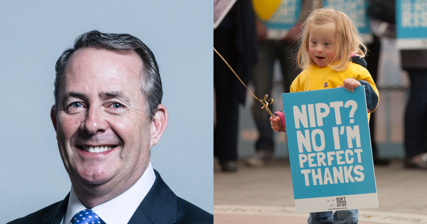 Press Release - Sir Liam Fox MP tables amendment to stop abortion up to birth for babies with Down's syndrome